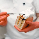 Dentist holding a cross-section tooth model to explain root canal treatment